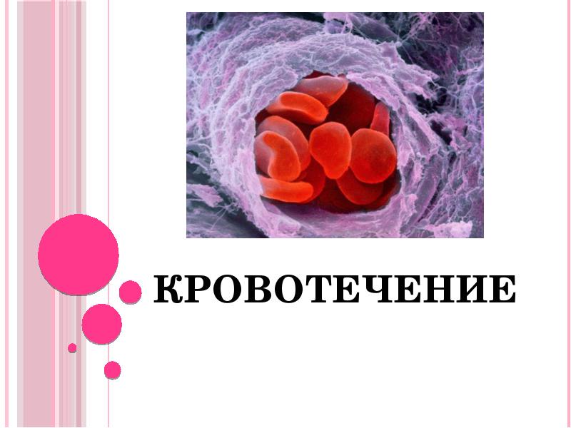 Кровотечение Кровотечение