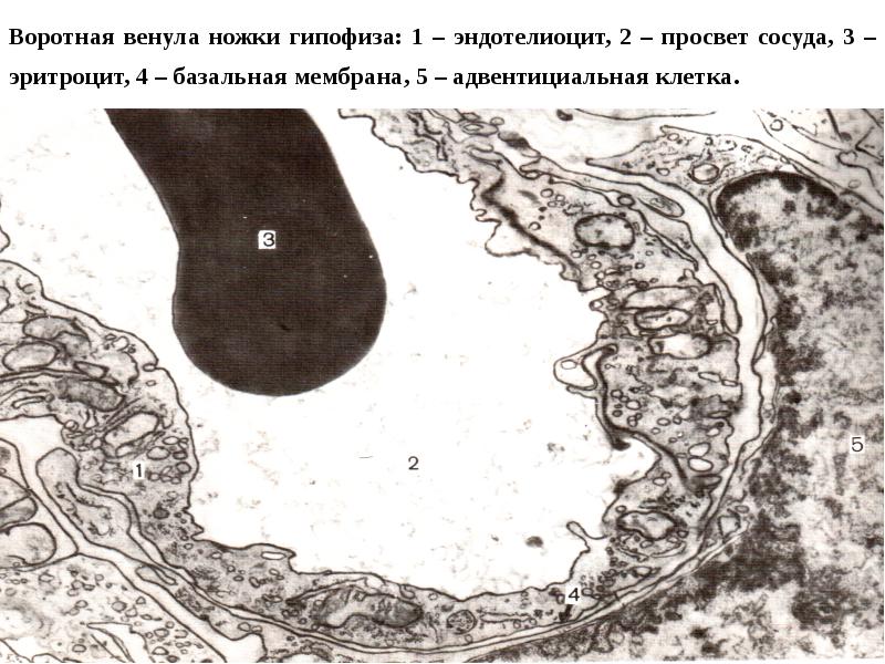 Просвет сосудов. Адвентициальные клетки эндотелиоциты. Адвентициальные клетки сосудов. Ультраструктура эндотелиоцита. Электронная микрофотография эндотелиоциты.