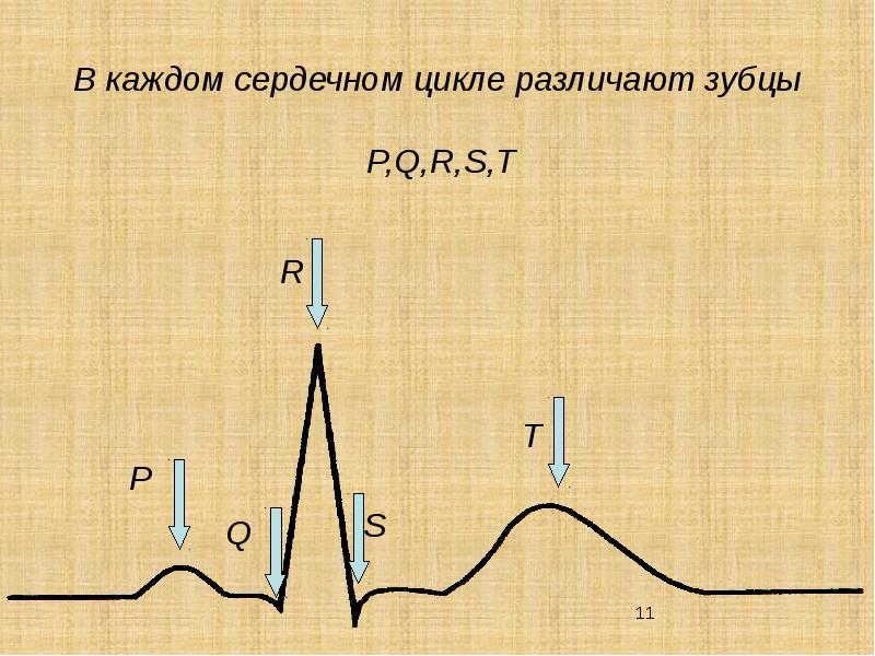 Сердечный каждый. Сердечный цикл. Зубцы сердечного цикла. Зубец p на t. Увеличение вольтажа зубцов это.