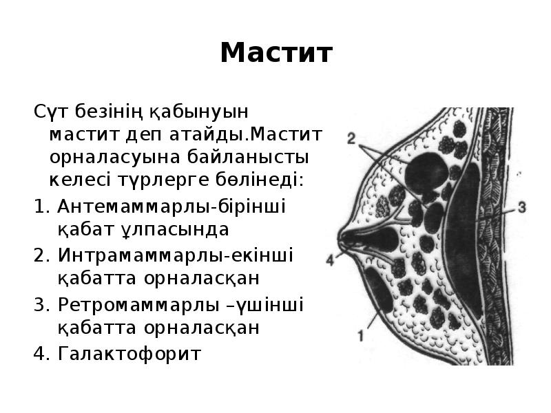 Мастита карта