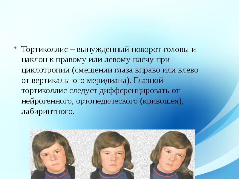 Патология глазодвигательного аппарата презентация