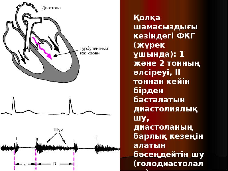 Жүрек ақаулары презентация