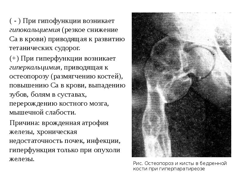 Гипофункция адреналина. Гипофункции затылочной области.