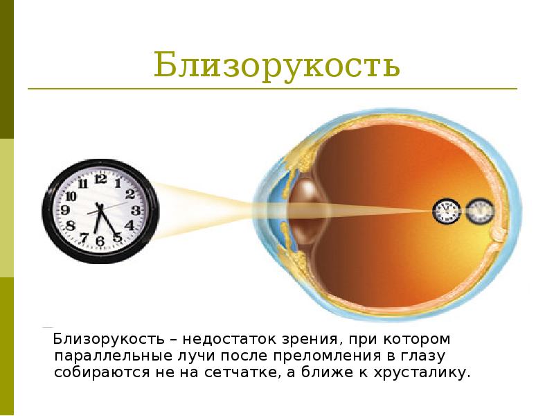 Презентация по теме глаз и зрение физика 8 класс