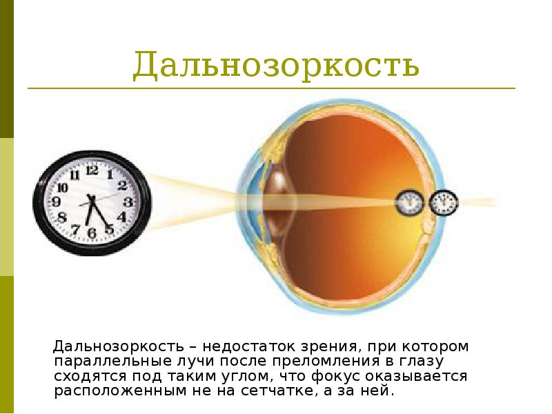 Проект по физике на тему глаз и зрение