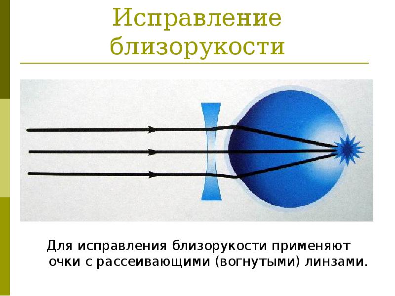 Презентация на тему глаз и зрение дефекты зрения