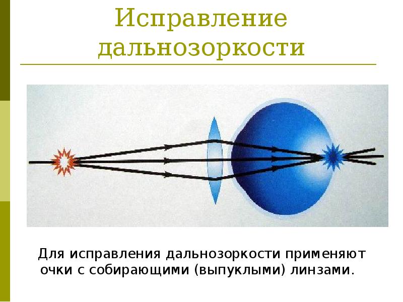 Презентация на тему глаз и зрение дефекты зрения