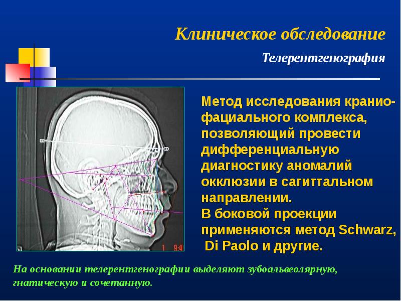 Врожденная патология кранио фациальной области презентация