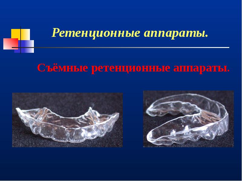 Ретенционные аппараты презентация