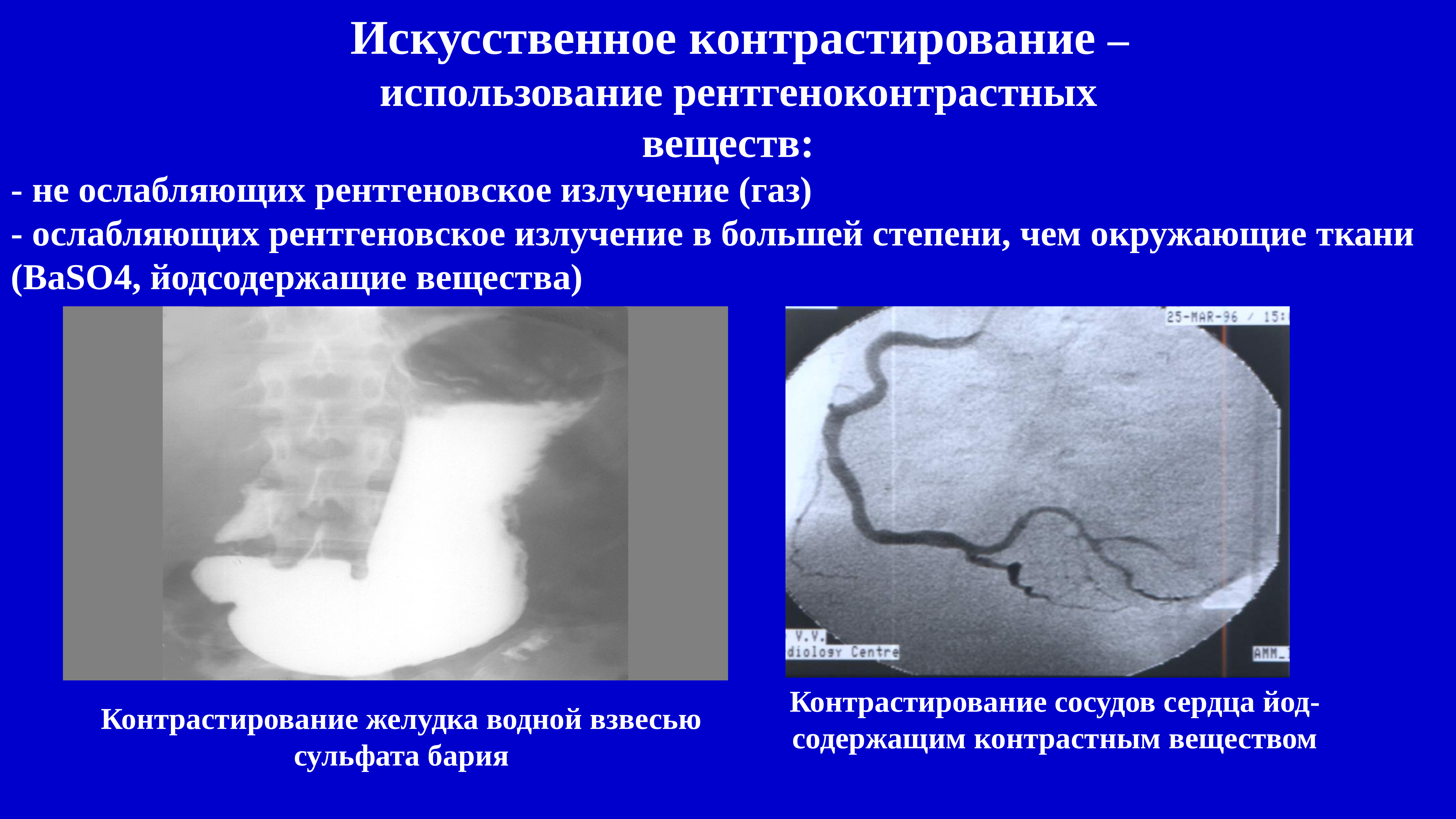 Методы контрастирования изображения