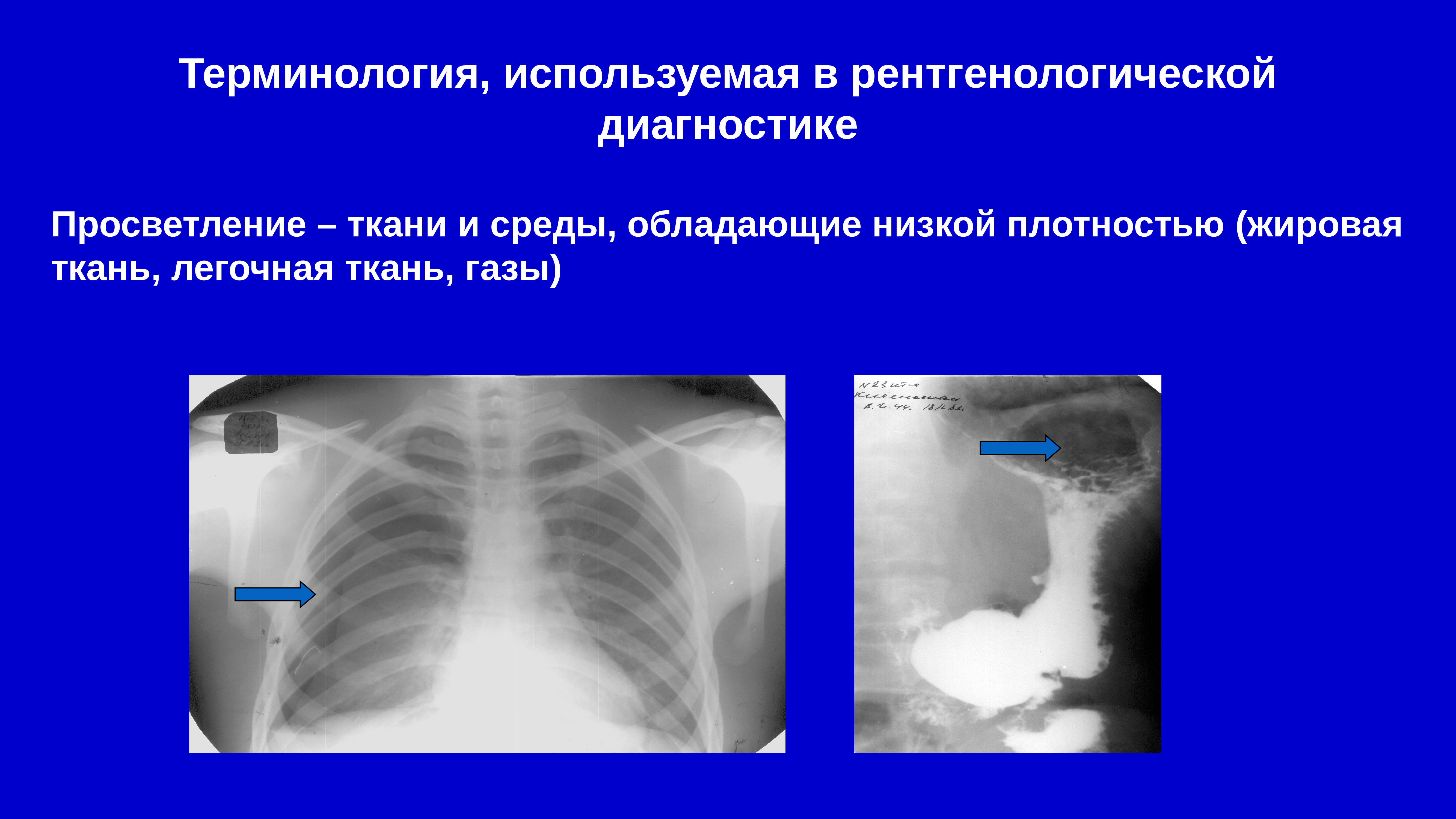 Общие вопросы лучевой диагностики презентация