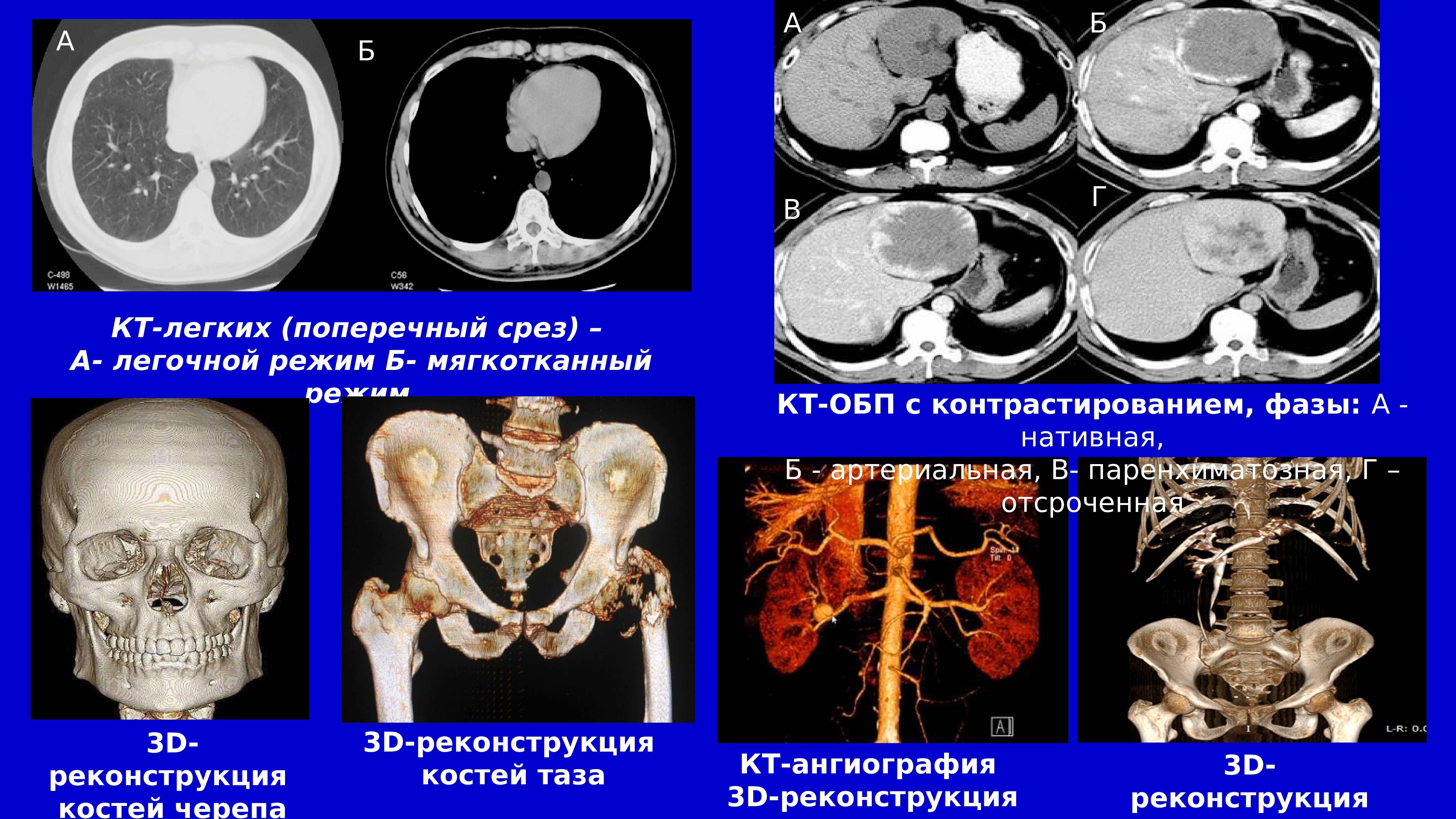 Mip изображение кт