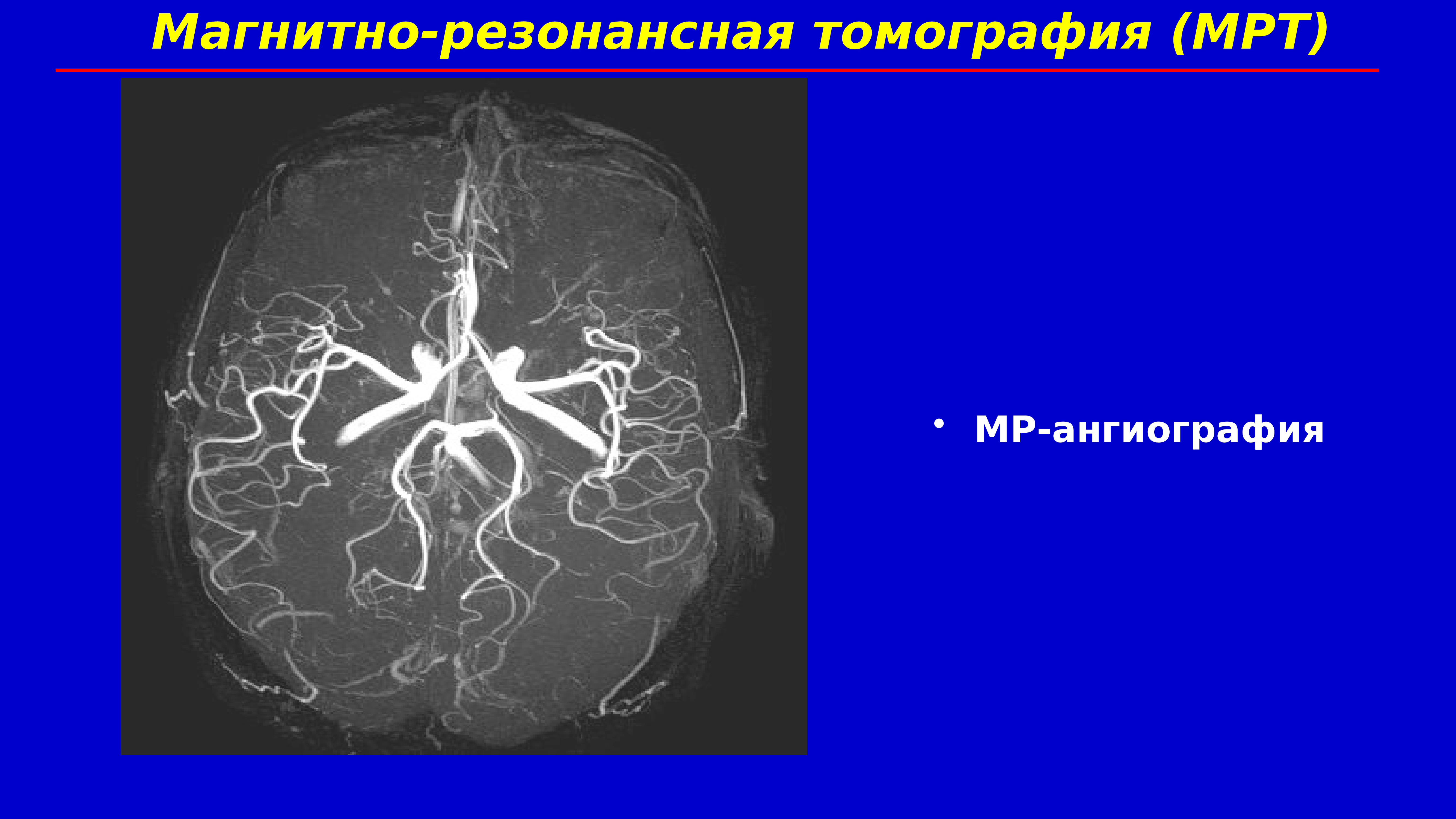 Бас ми жарақаттары презентация