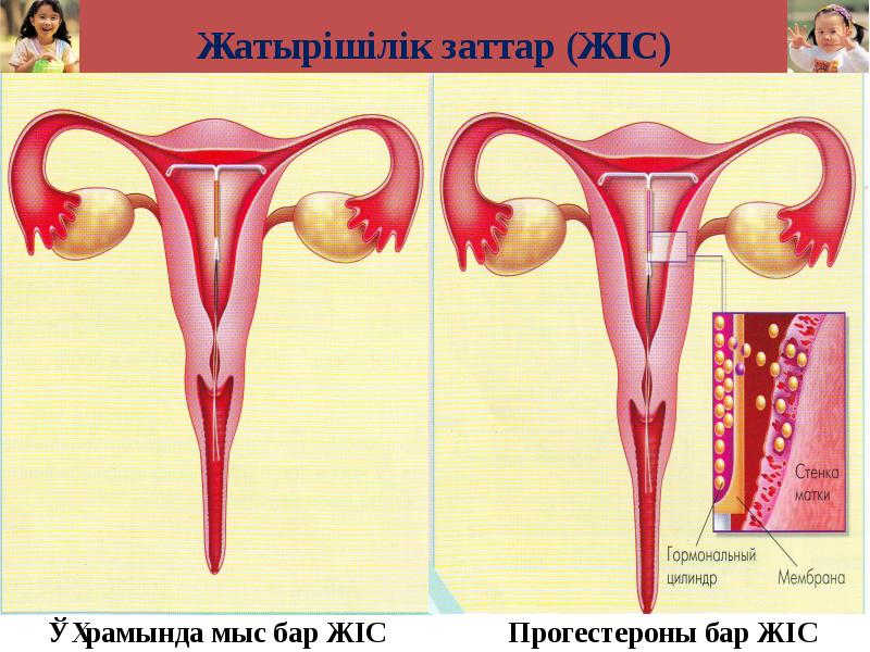 Жатырішілік заттар (ЖІС)
