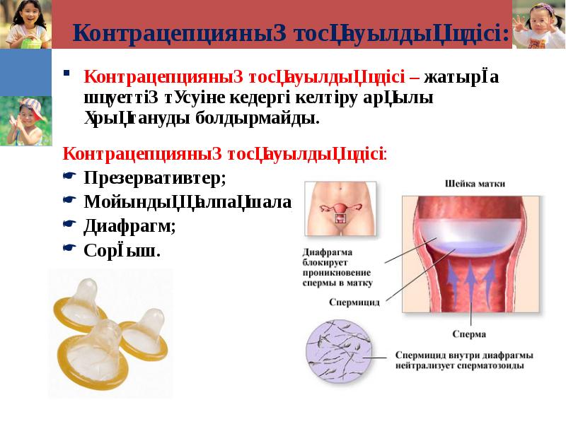 Контрацепцияның тосқауылдық әдісі: Контрацепцияның тосқауылдық әдісі – жатырға шәуеттің түсуіне кедергі