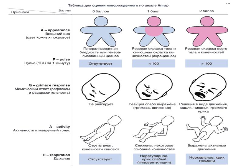 Асфиксия легкой степени по апгар. Шкала апгар рефлексы. шкала апгар для новорожденных. шкала апгар для новорожденных таблица. степени асфиксии по апгар.