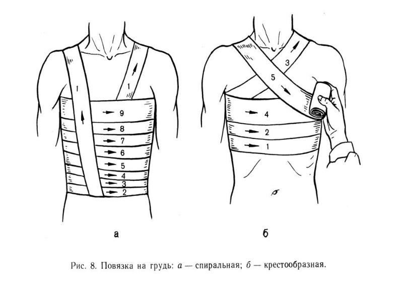 Окклюзионная повязка рисунок