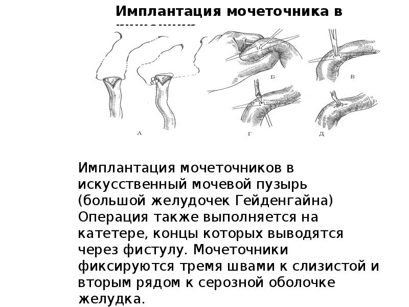 Цистотомия мочевого пузыря. Экспериментальная хирургия презентация. Экспериментальный хирургия тесты.