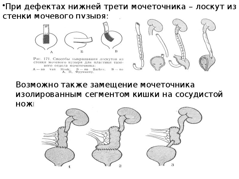 Цистотомия мочевого пузыря. Экспериментальные почек. Экспериментальный хирургия тесты. Скалапочка и Алегза тафалоз.