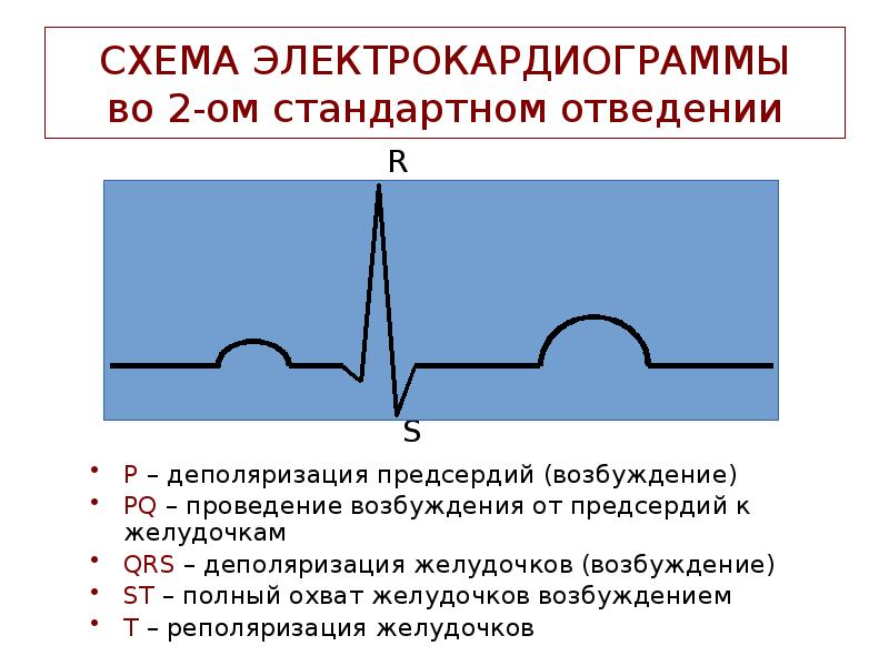 Реполяризация желудочков на экг. ЭКГ QRS деполяризация возбуждение. Деполяризацию миокарда желудочков отражает. Возбуждение желудочков на ЭКГ. Процессы деполяризации на ЭКГ.