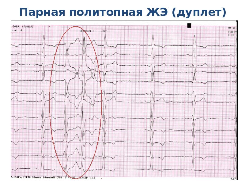 Описание экг по фото онлайн бесплатно