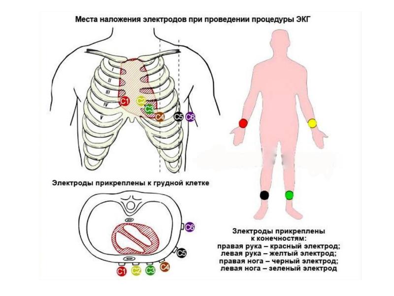 Датчики экг схема