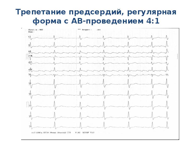 22010001 какой банк карта мир