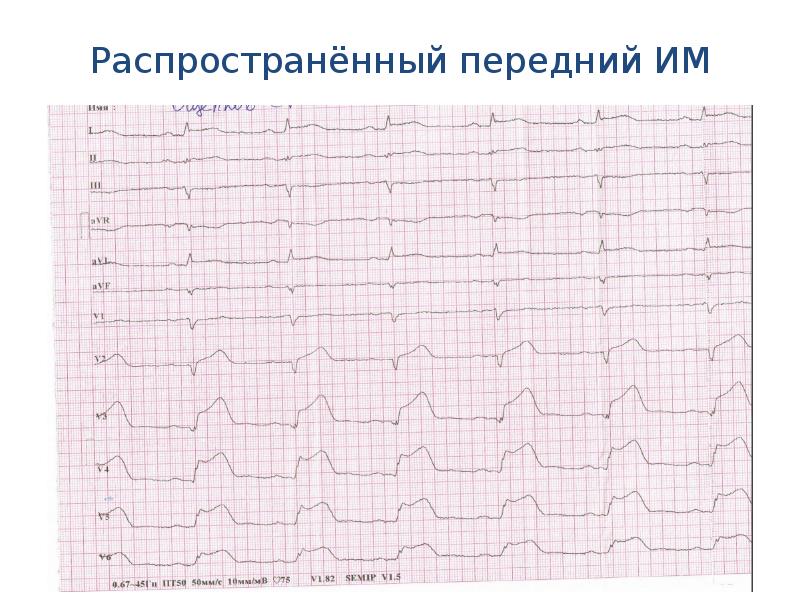 Экг в схемах и таблицах