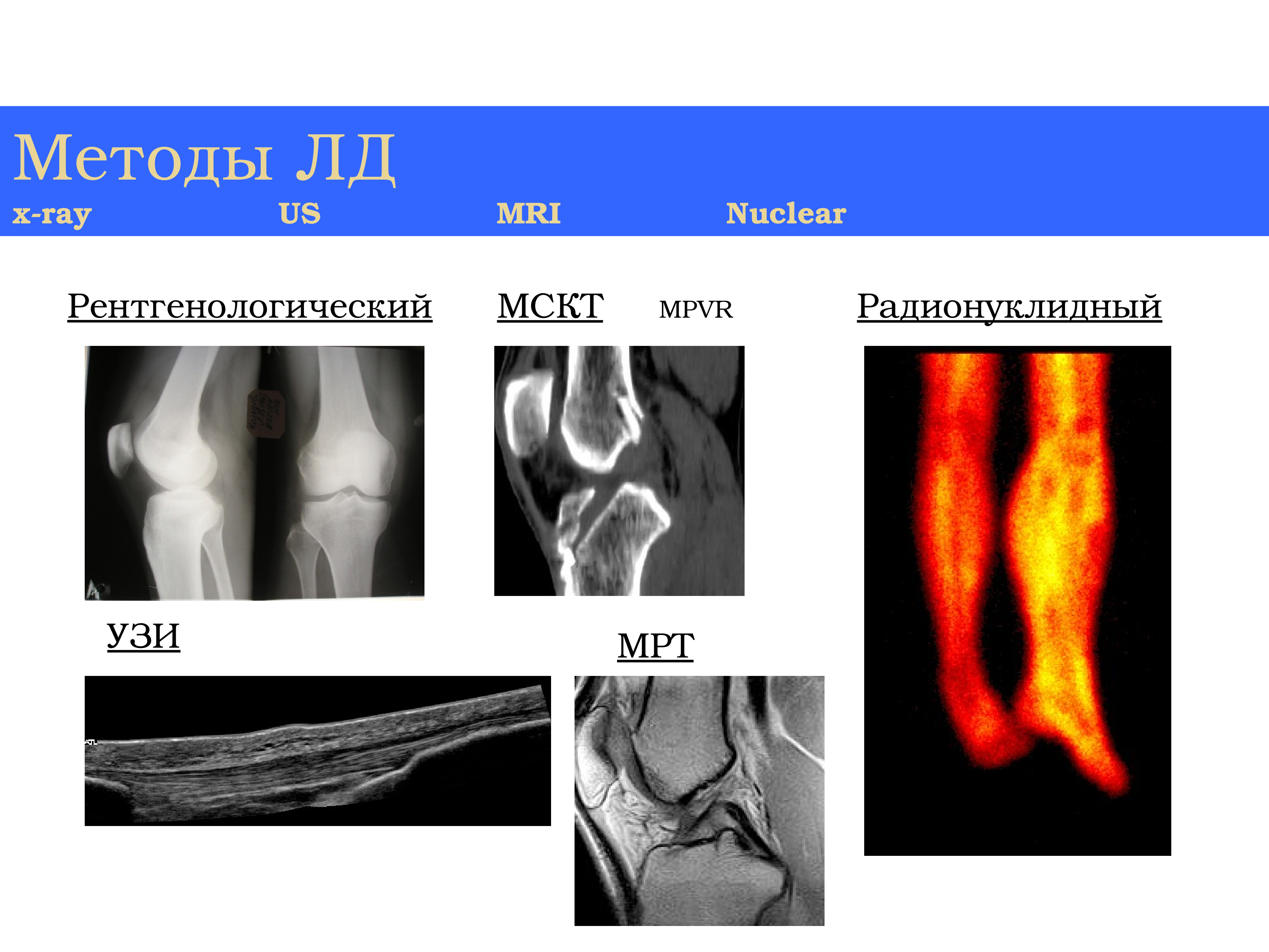 Лучевая диагностика опорно двигательной системы презентация