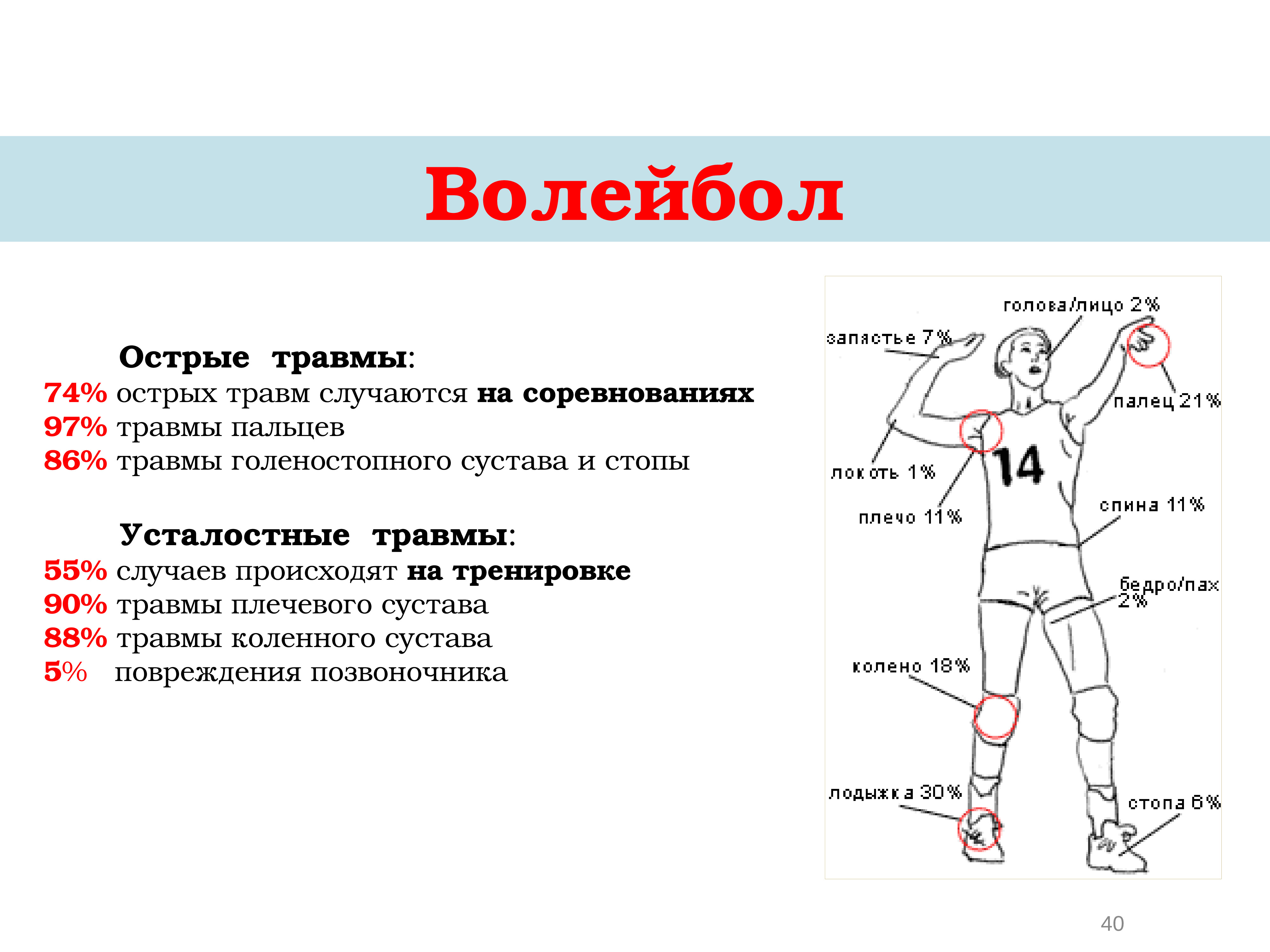 Нарушения при подаче. Травмы в волейболе. Статистика травм в волейболе. Травматизм в волейболе.