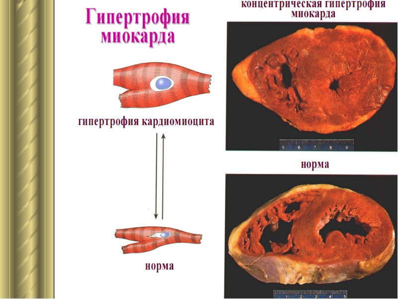 Полиорганная недостаточность патофизиология презентация