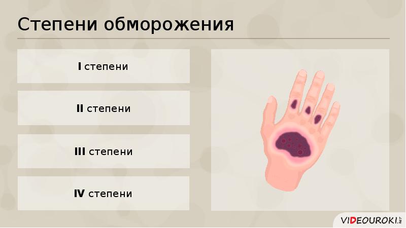 Травмы и болезни кожи 8 класс презентация