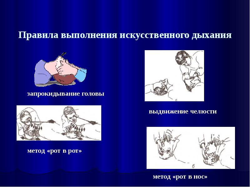 Проведение искусственного