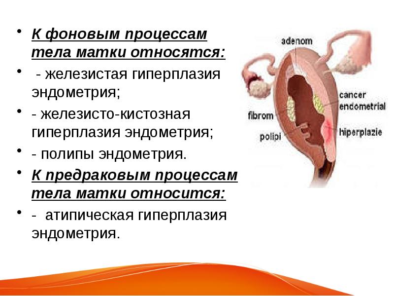 Гиперплазия эндометрия матки презентация