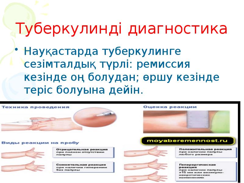 Туберкулинді диагностика Науқастарда туберкулинге сезімталдық түрлі: ремиссия кезінде оң болудан; өршу