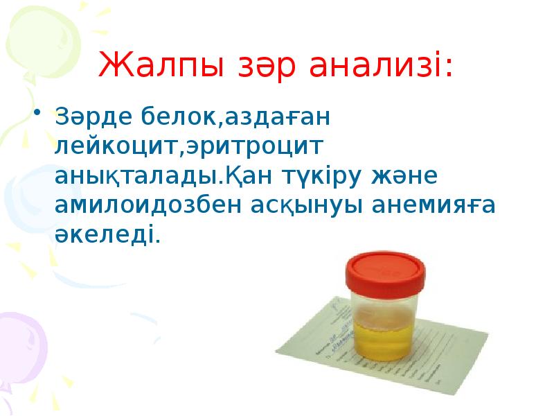 Жалпы зәр анализі: Зәрде белок,аздаған лейкоцит,эритроцит анықталады.Қан түкіру және амилоидозбен асқынуы