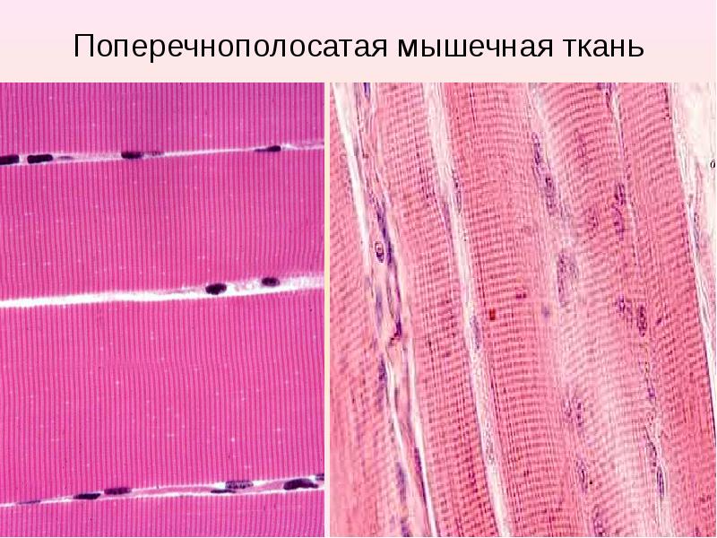 Скелетные мышцы фото под микроскопом