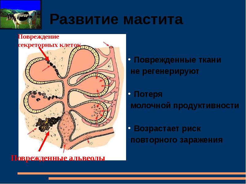 Острый мастит презентация