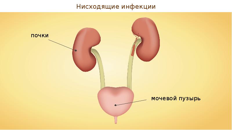 Заболевания органов мочевыделения презентация 8 класс пасечник