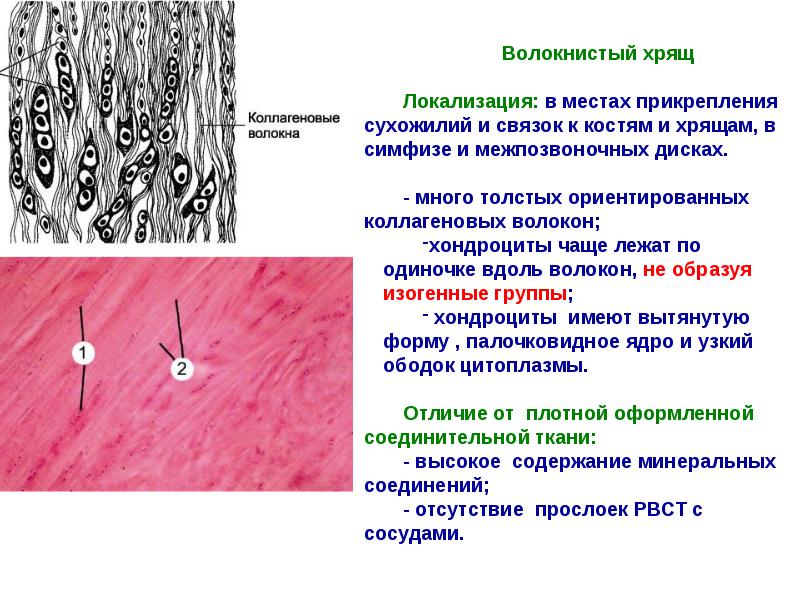 Волокнистый хрящ рисунок