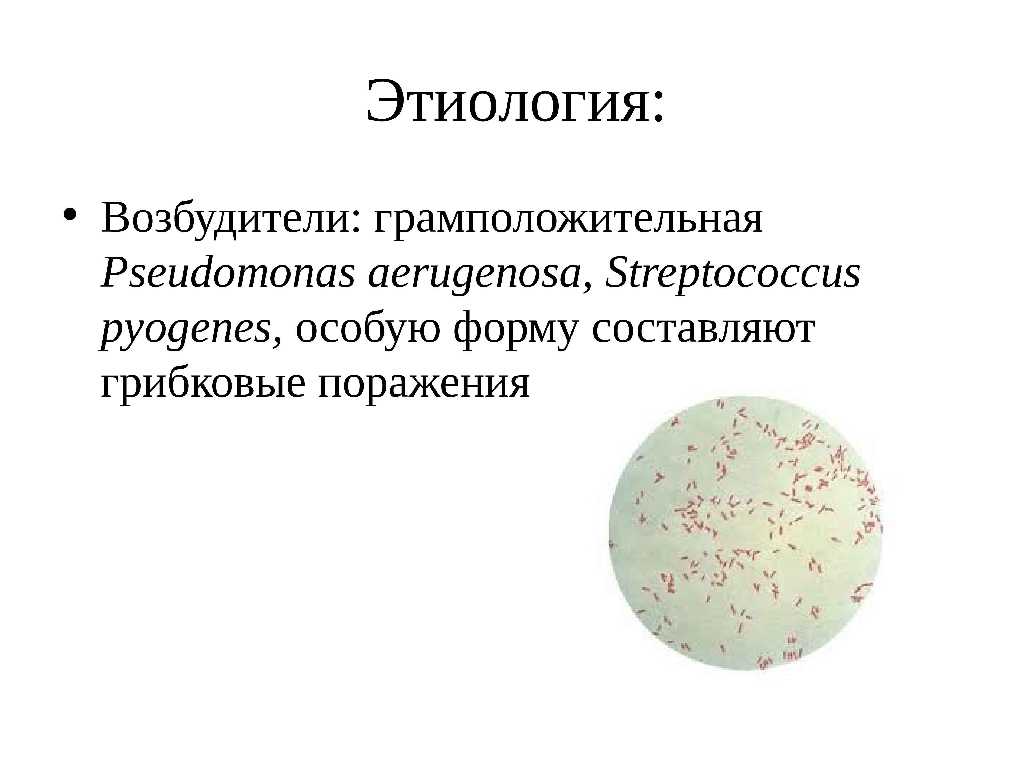 Стрептококк заболевания. Стрептококки заболевания. Стрептококк пиогенес заболевания. Сестринский уход при заболеваниях уха и сосцевидного отростка.