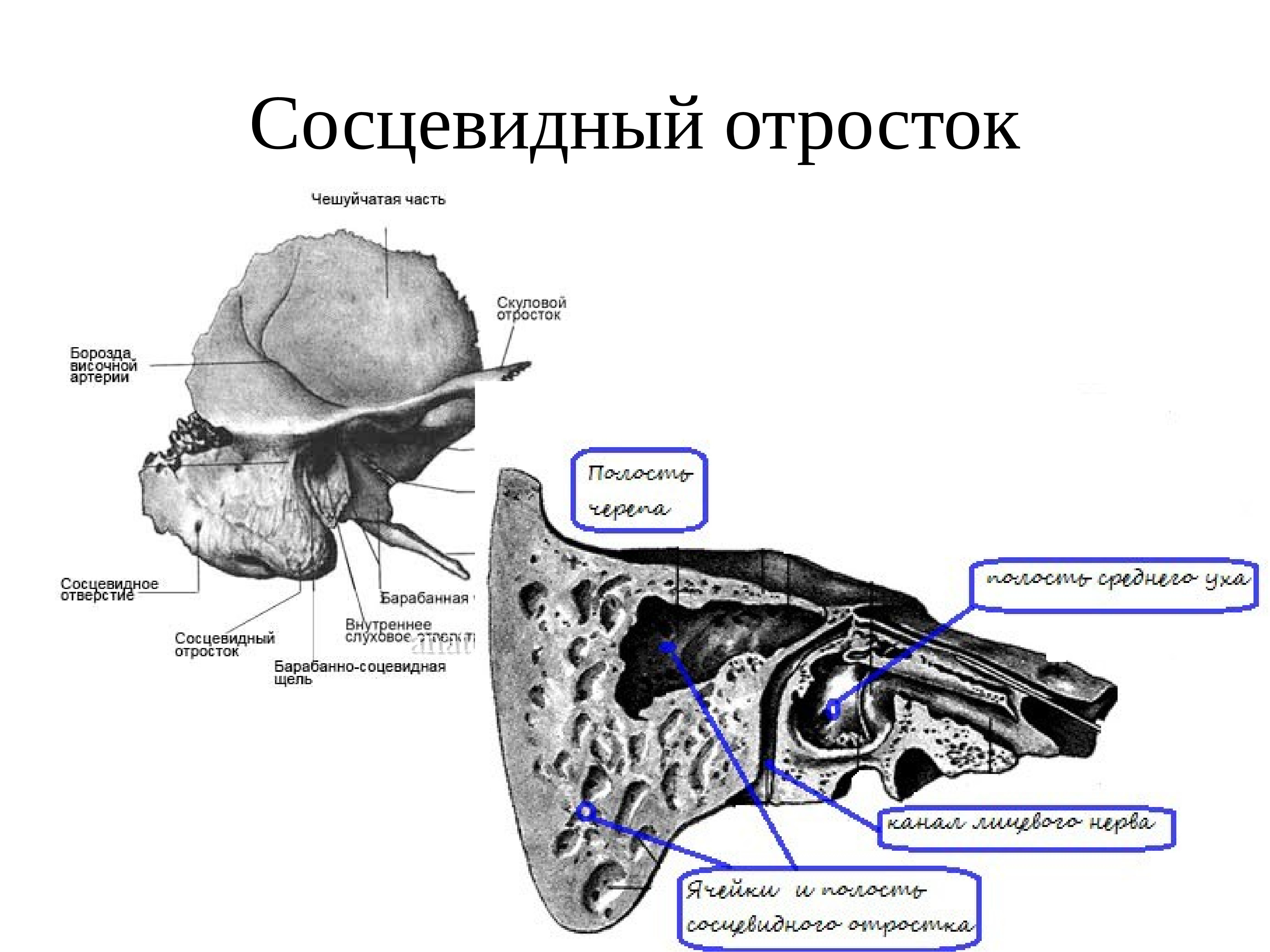 Ухо человека расположено в полости кости. Строение кости сосцевидного отростка. Сэцевидный о Росток весочной кости. Сосцевидный отросток височной кости анатомия. Анатомия среднего уха и сосцевидного отростка.