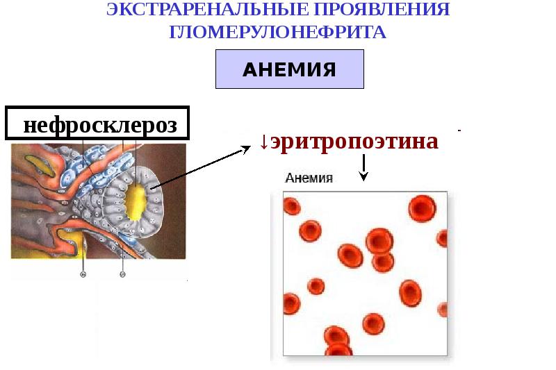 Патофизиология почек презентация