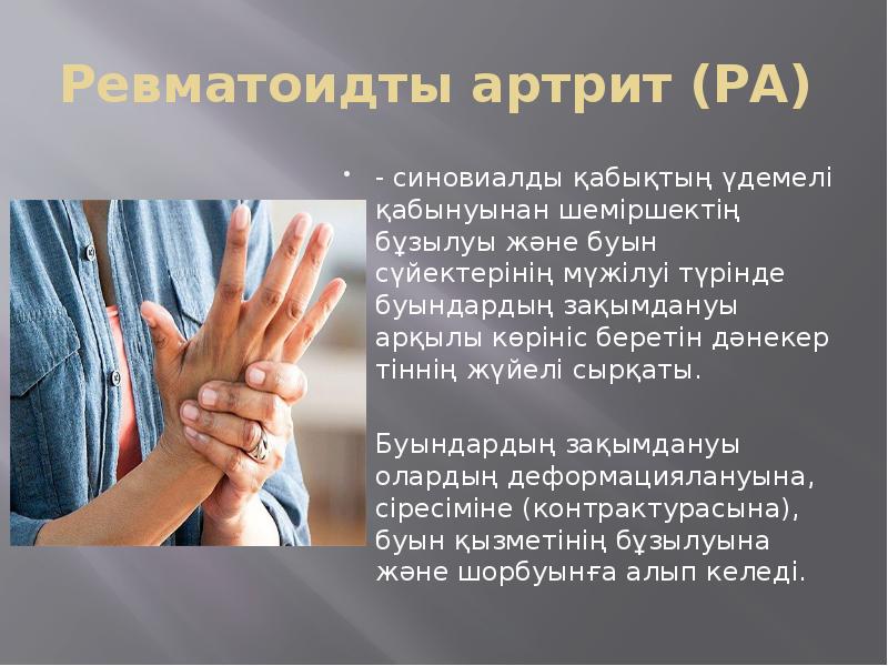 Ревматоидты артрит (РА)  - синовиалды қабықтың үдемелі қабынуынан шеміршектің бұзылуы
