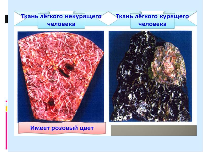 Какая ткань в легких. Легкие курящего человека. Лёгкие здорового человека и курильщика. Легкие курильщика в разрезе.