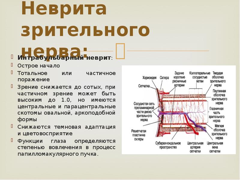 Неврит зрительного нерва. Неврит зрительного нерва патогенез. Симптомы при неврите зрительного нерва. При невритах зрительного нерва зрение. Основные признаки острого неврита зрительного нерва.