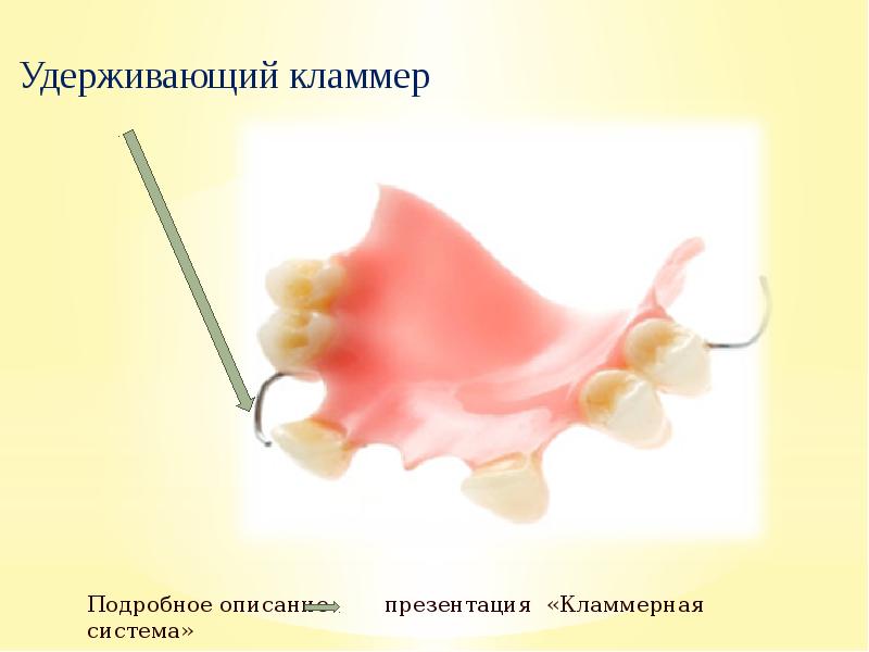 Доғалы протез презентация