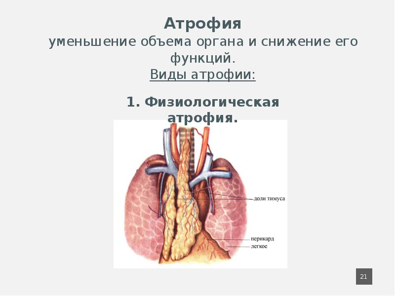 Атрофия презентация патология