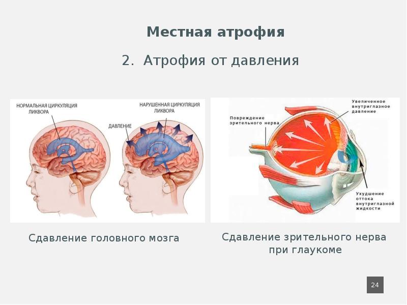 Какие виды повреждений файлов и дисков вам известны