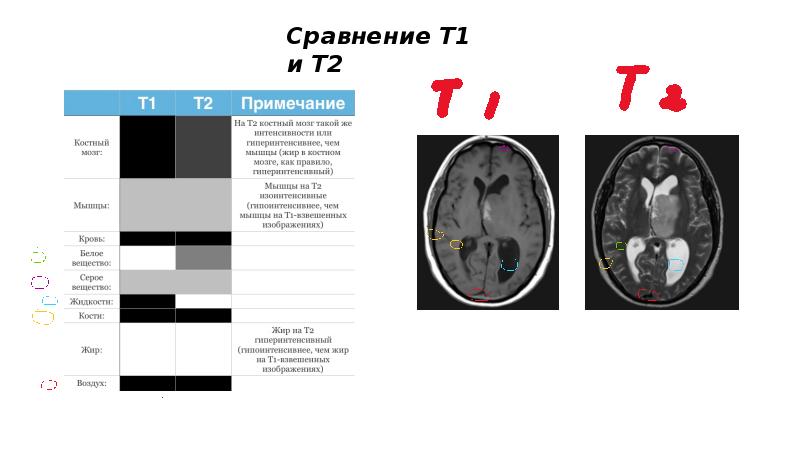 Т1 и т2 взвешенные изображения в мрт